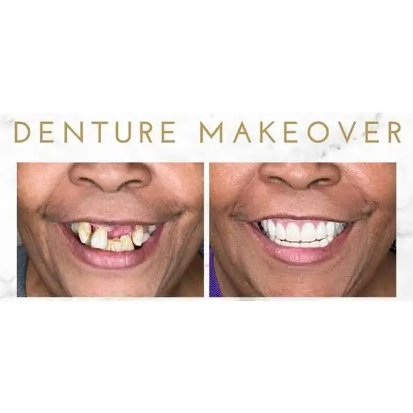Tinley Park Smiles & Implant Dentistry