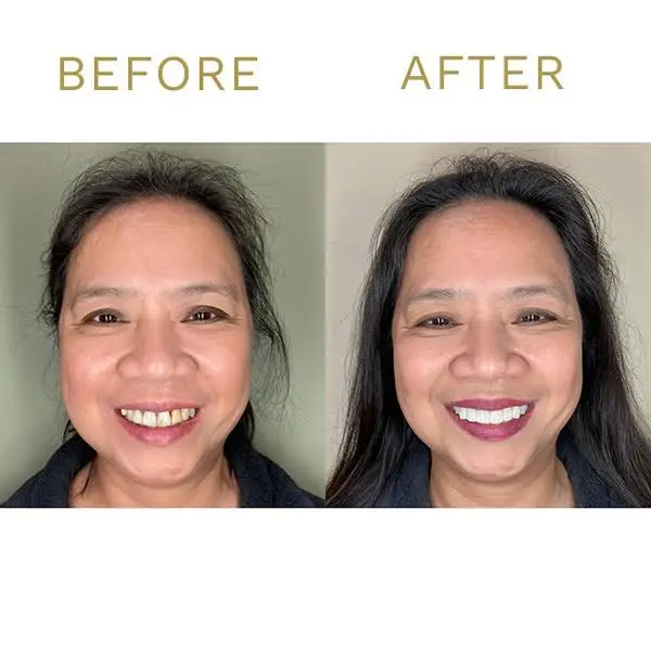 Tinley Park Smiles & Implant Dentistry
