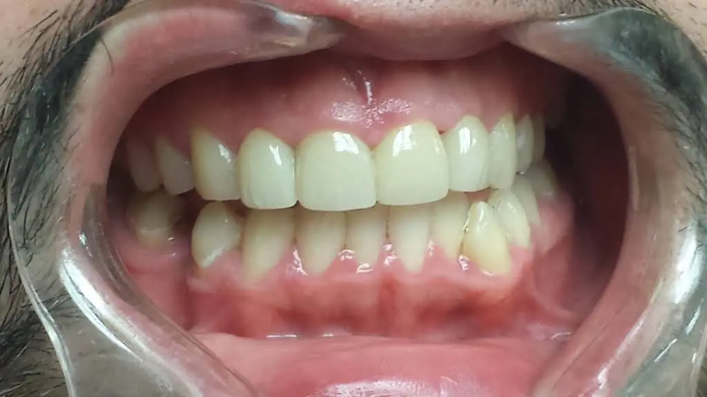 Plano Family Dental