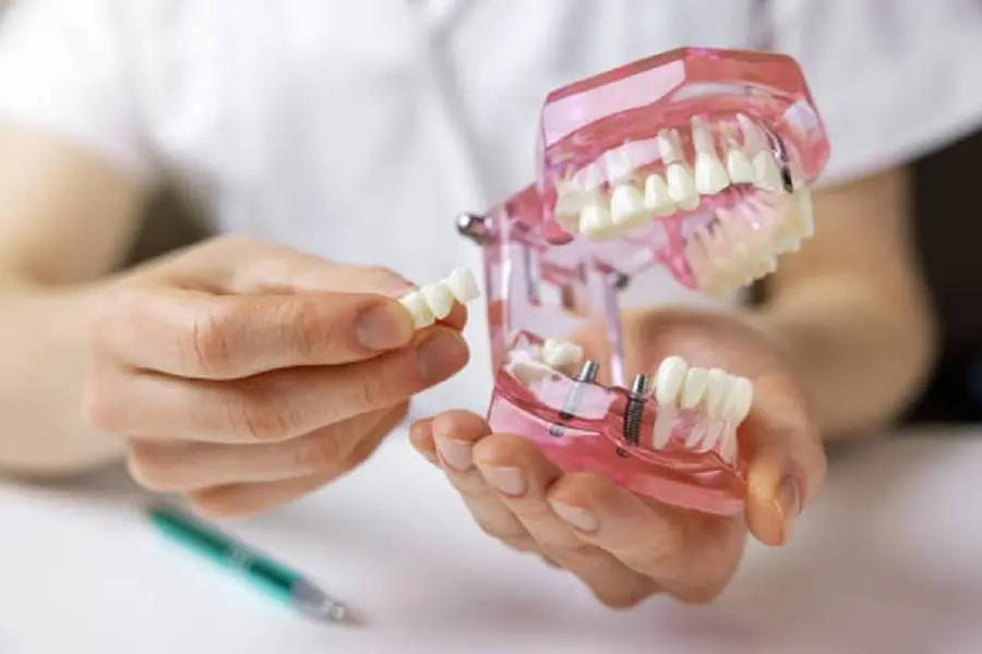 Canyon Gate Dental