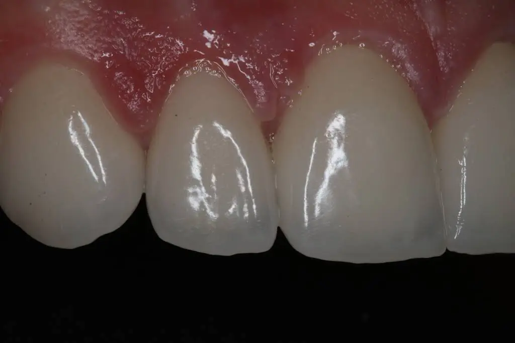Champions for Oral Health