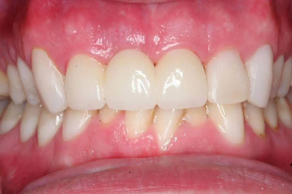 Tysons Dental Esthetics