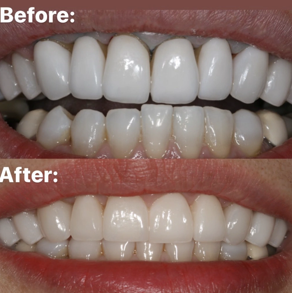 Tysons Corner Advanced Dental Center
