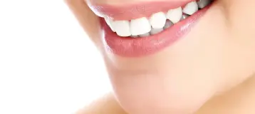 Landmark Smile