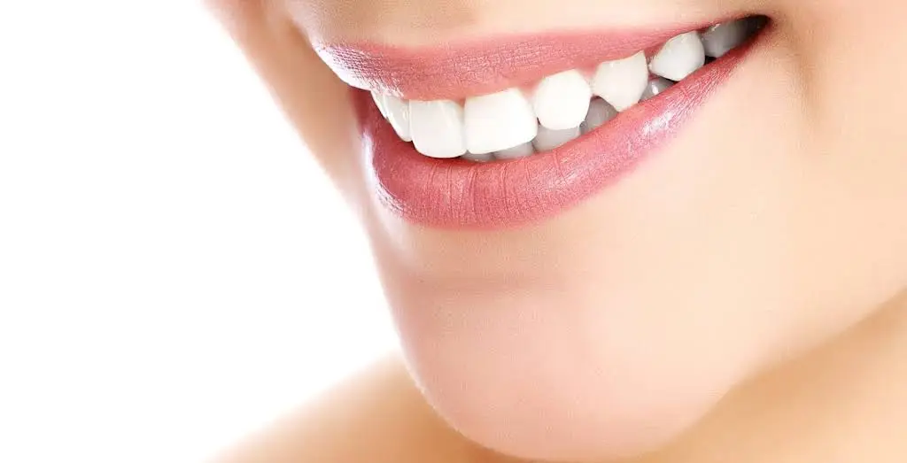 Landmark Smile