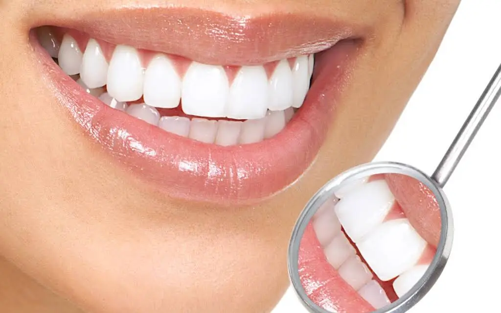 Landmark Smile