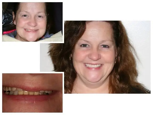 Gibberman Dental