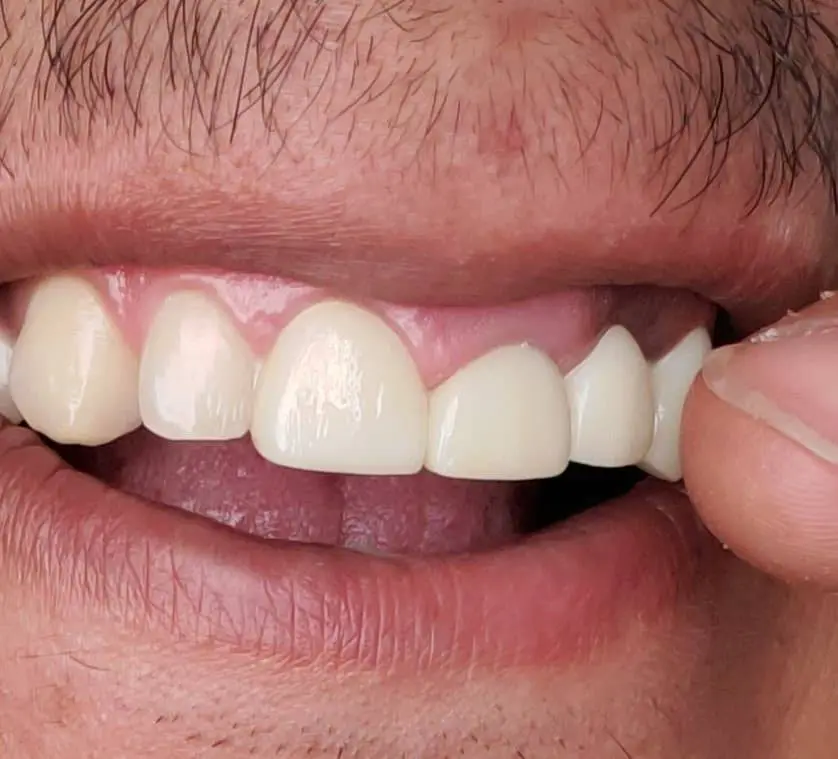 Half Price Dental
