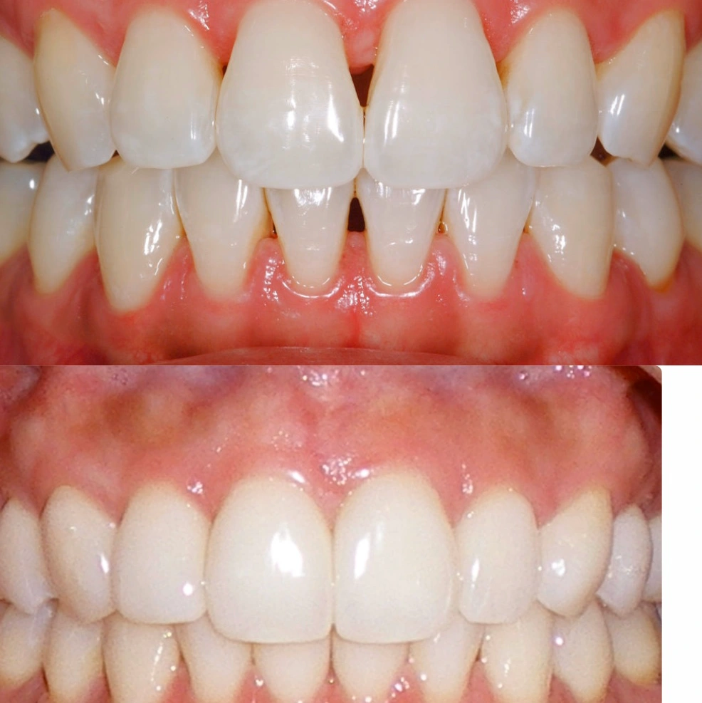 Dental Design of Wheaton