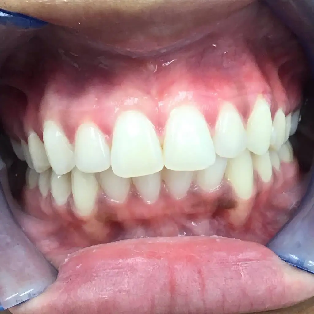 Aspen Hill Implant & Family Dentistry, P.C.
