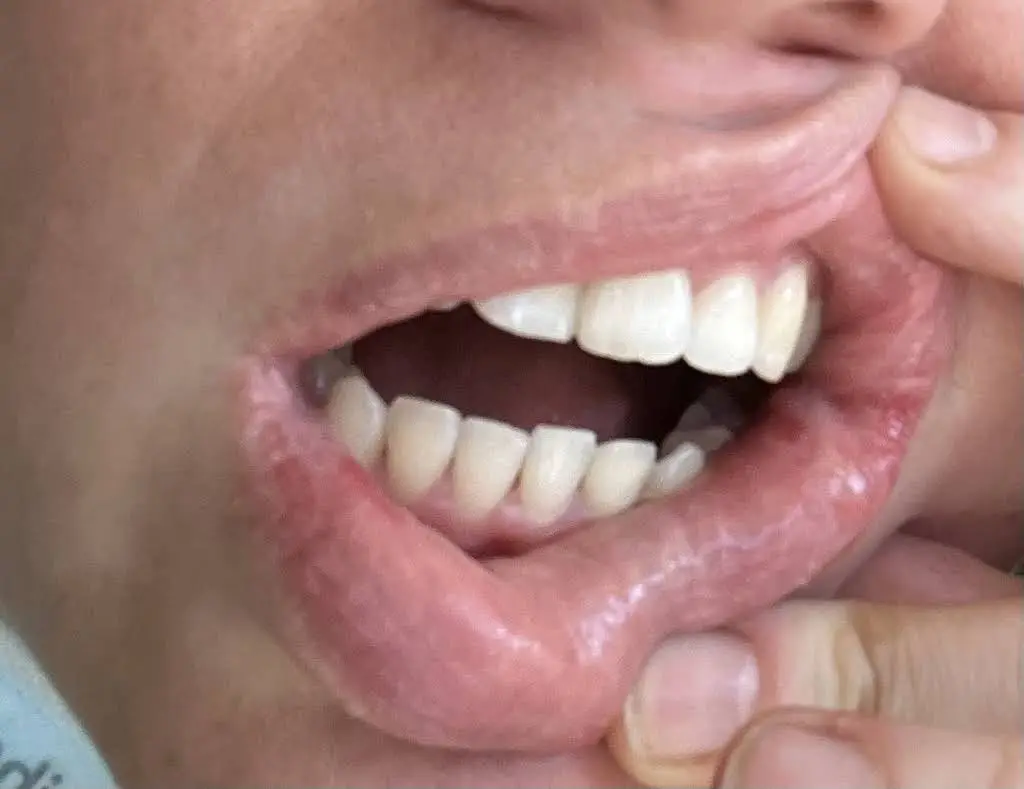 Lake Arbor Dental Associates of Maryland