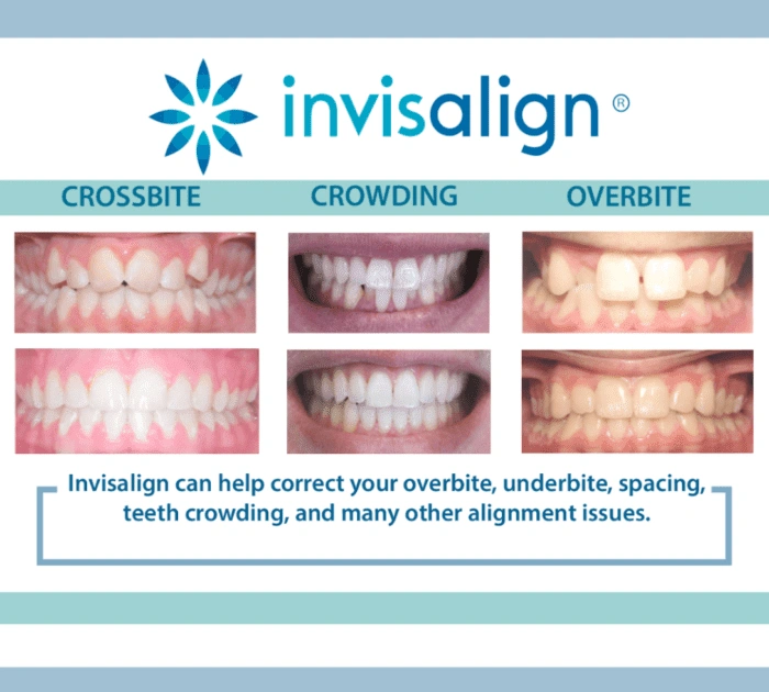 Merrifield Dental