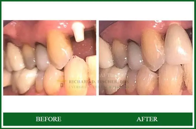 Evergreen Dental Wellness