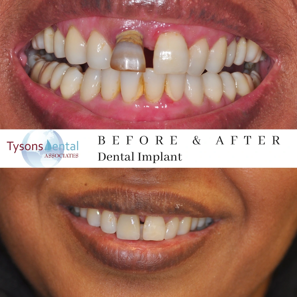 Tysons Dental