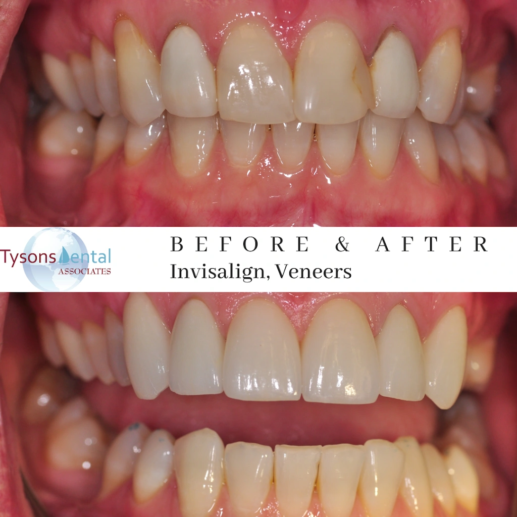 Tysons Dental