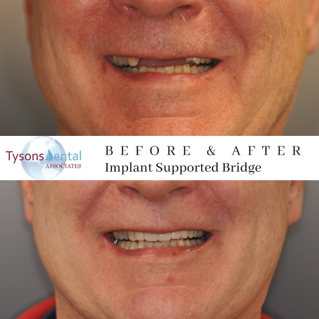 Tysons Dental