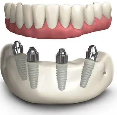 Springdale Family Dentistry