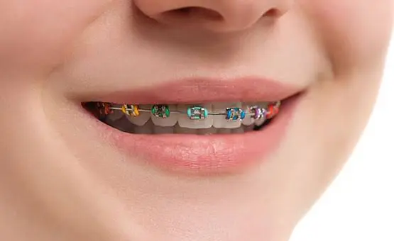 Springdale Family Dentistry