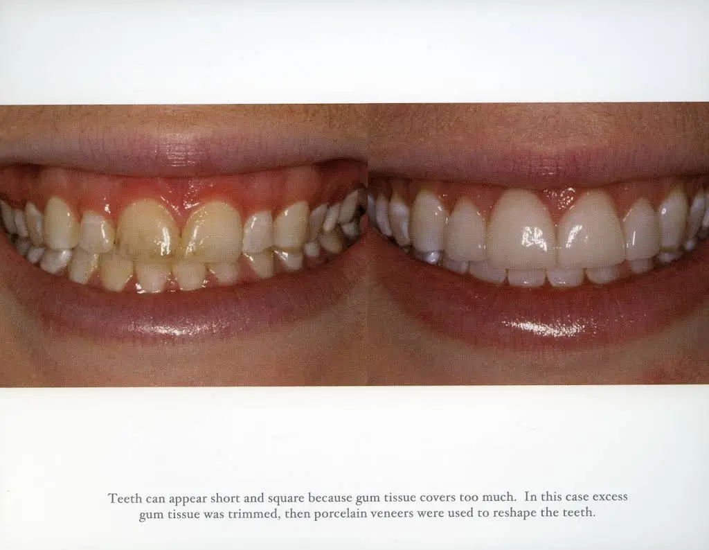 Performance Dental Care