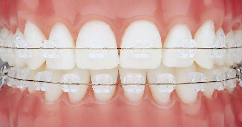 Nord Orthodontics