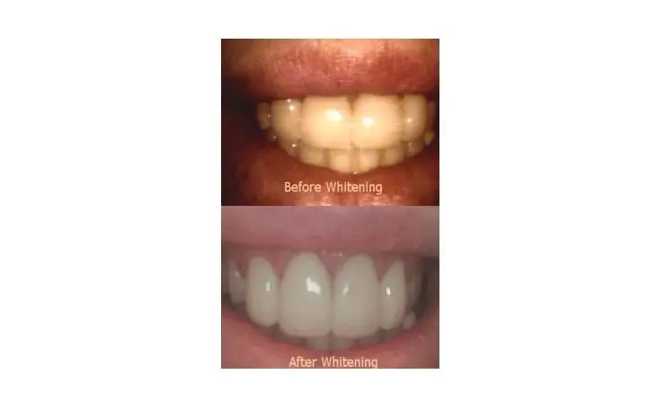 Young Family Dental Orem