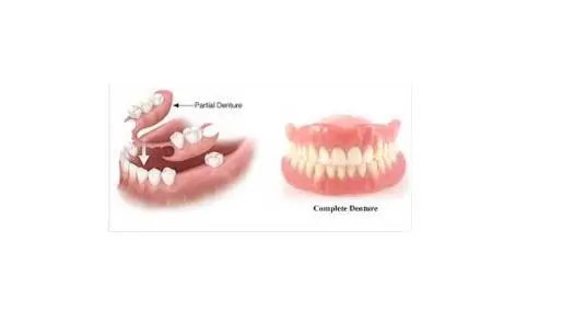 Young Family Dental Orem