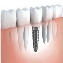 Young Family Dental Orem