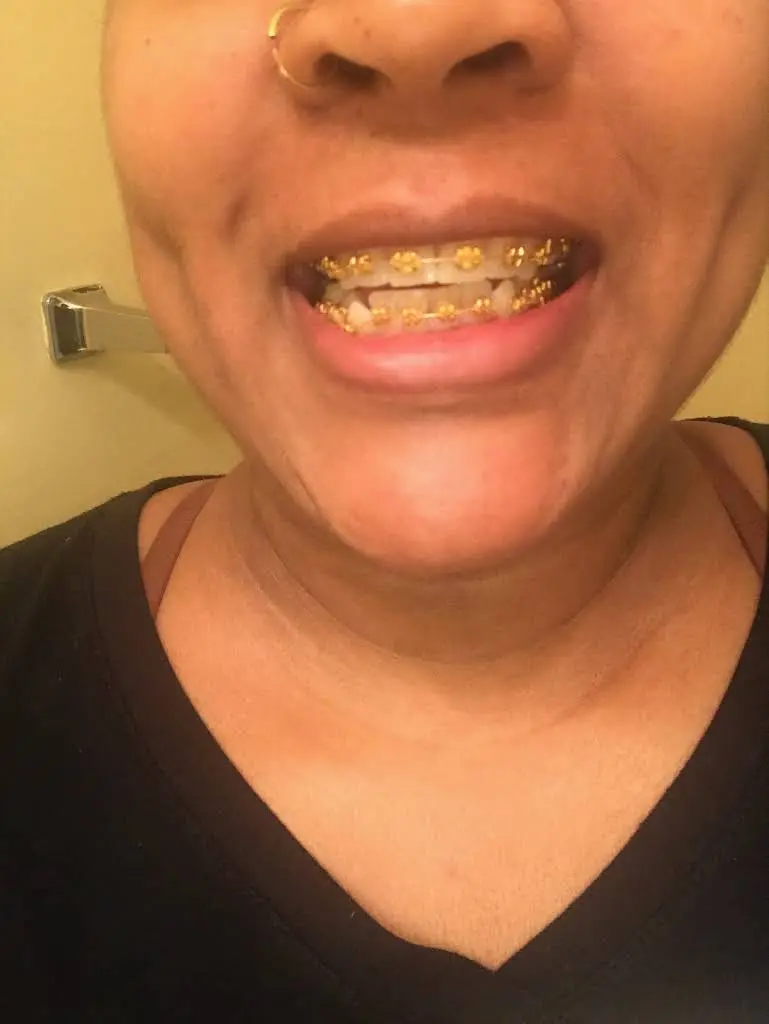Harmon Orthodontics