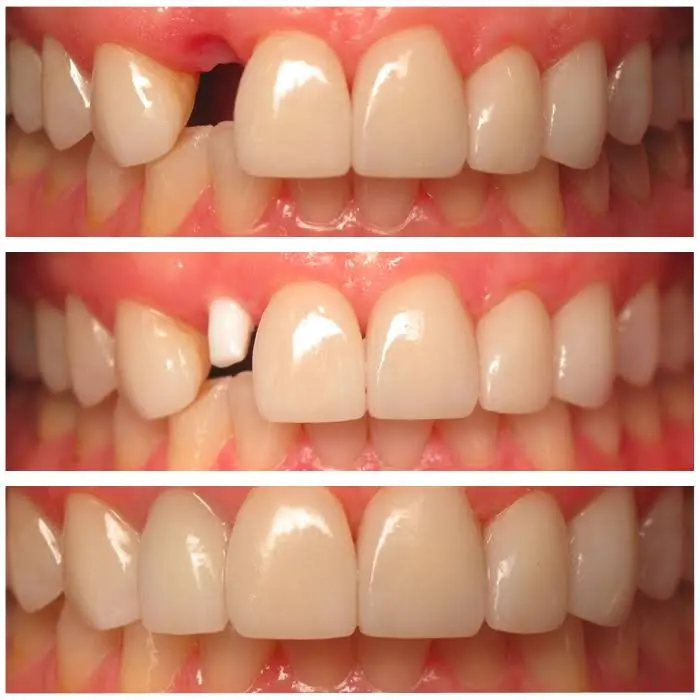 Maryland Holistic Dentist