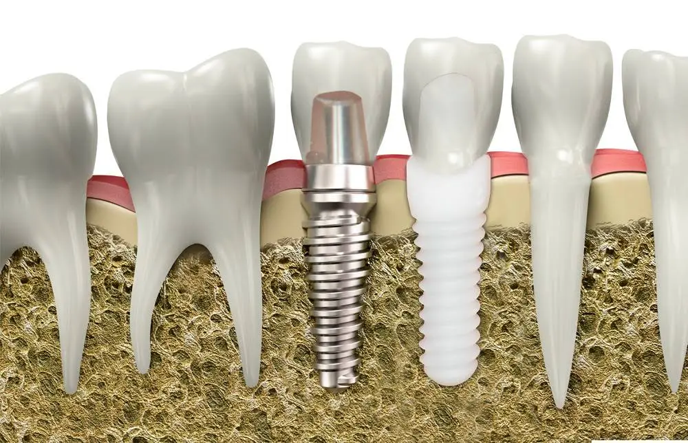 Maryland Holistic Dentist