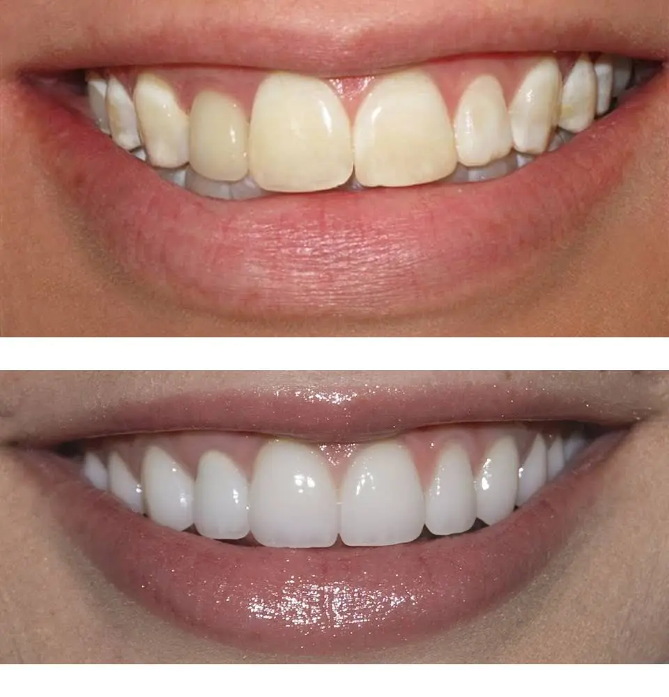 Maryland Sedation Dentist