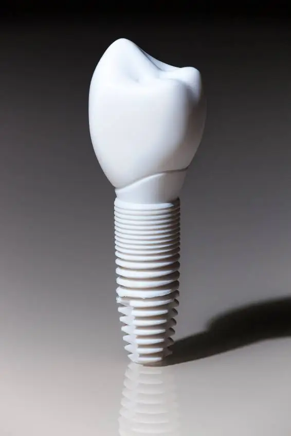 Maryland Sedation Dentist