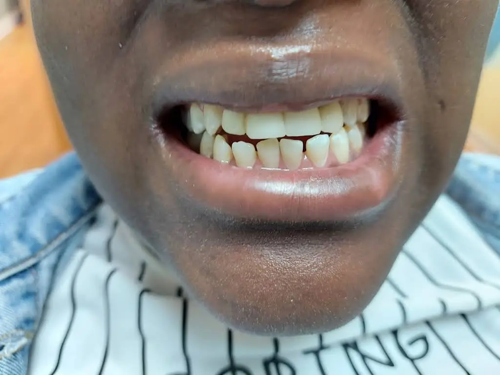 USmile Dental