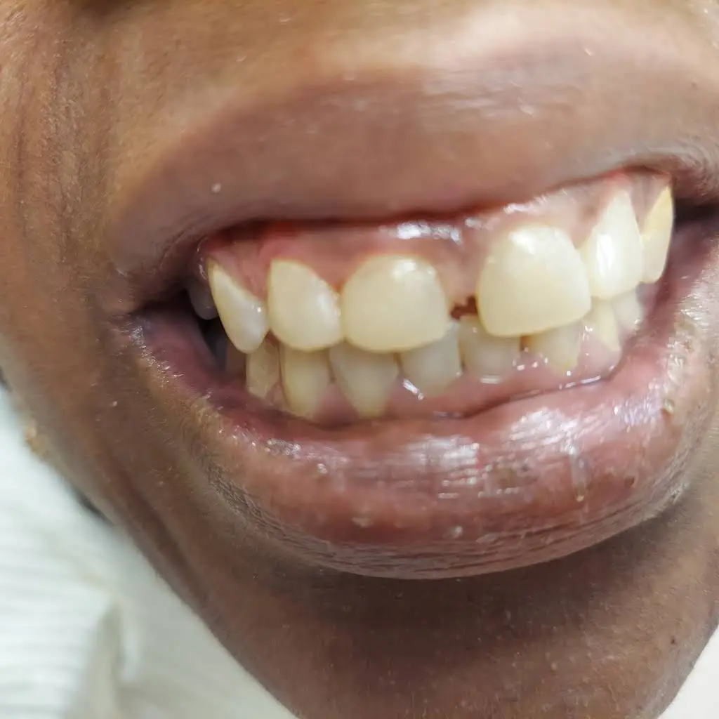 USmile Dental