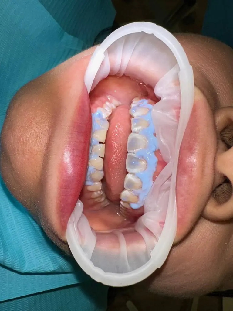USmile Dental