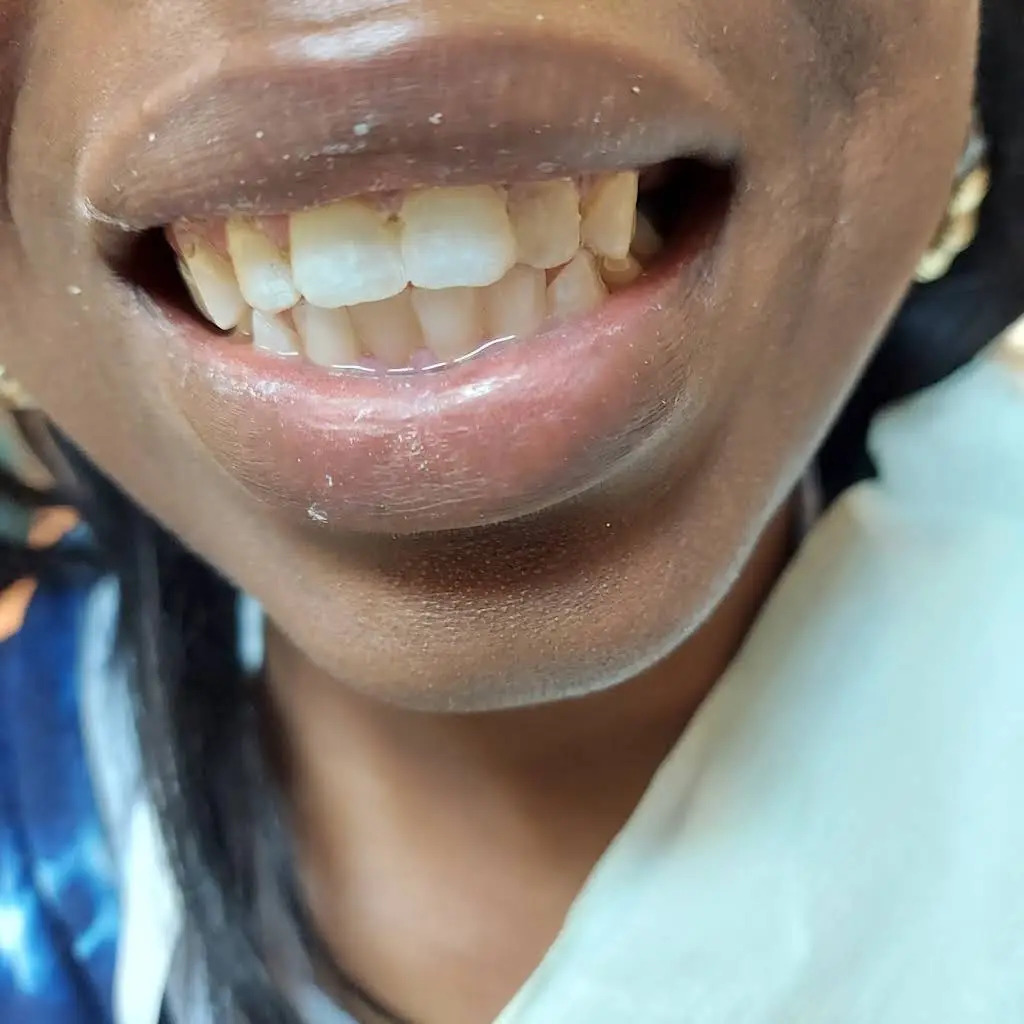 USmile Dental