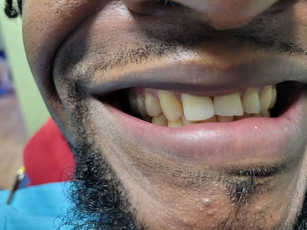 USmile Dental