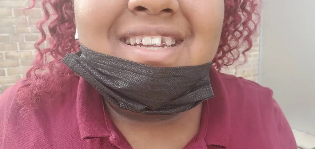 Clinton Braces and Invisalign
