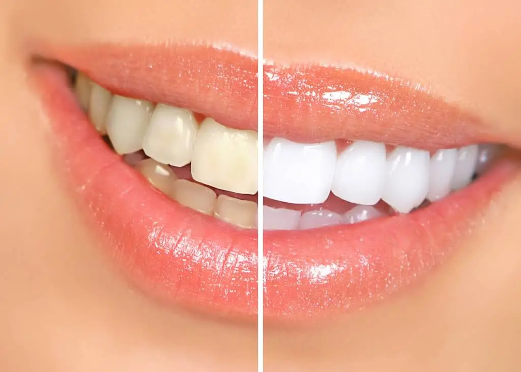 Esthetic Dentistry of Fairfax