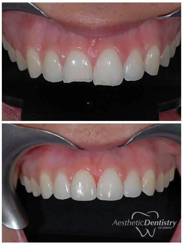 Esthetic Dentistry of Fairfax
