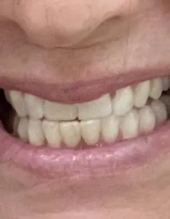 Novel Smiles