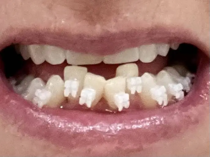 Novel Smiles
