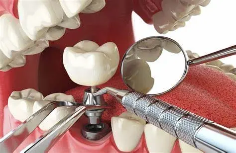 3D Dental Care