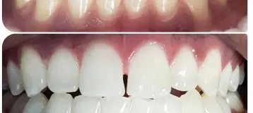 A to Z Dental, LLC