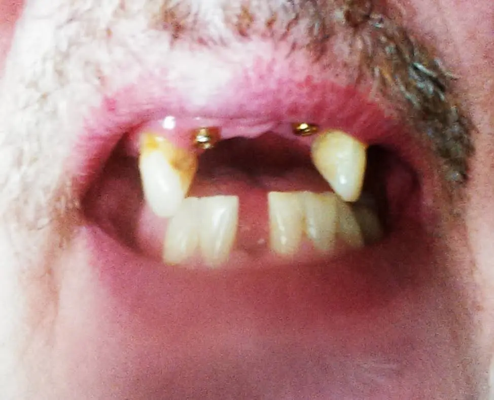 Dental Fields