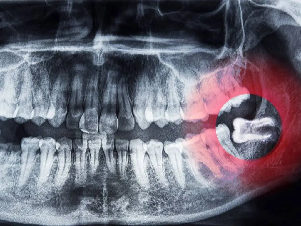 Advanced Dental Care Of Provo