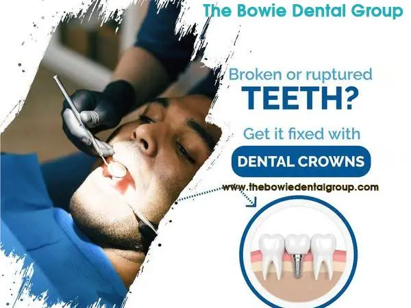 The Bowie Dental Group