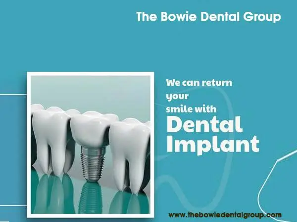 The Bowie Dental Group