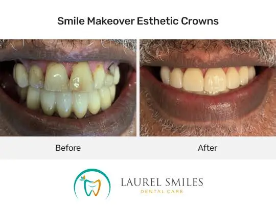 Laurel Smiles Dental Care