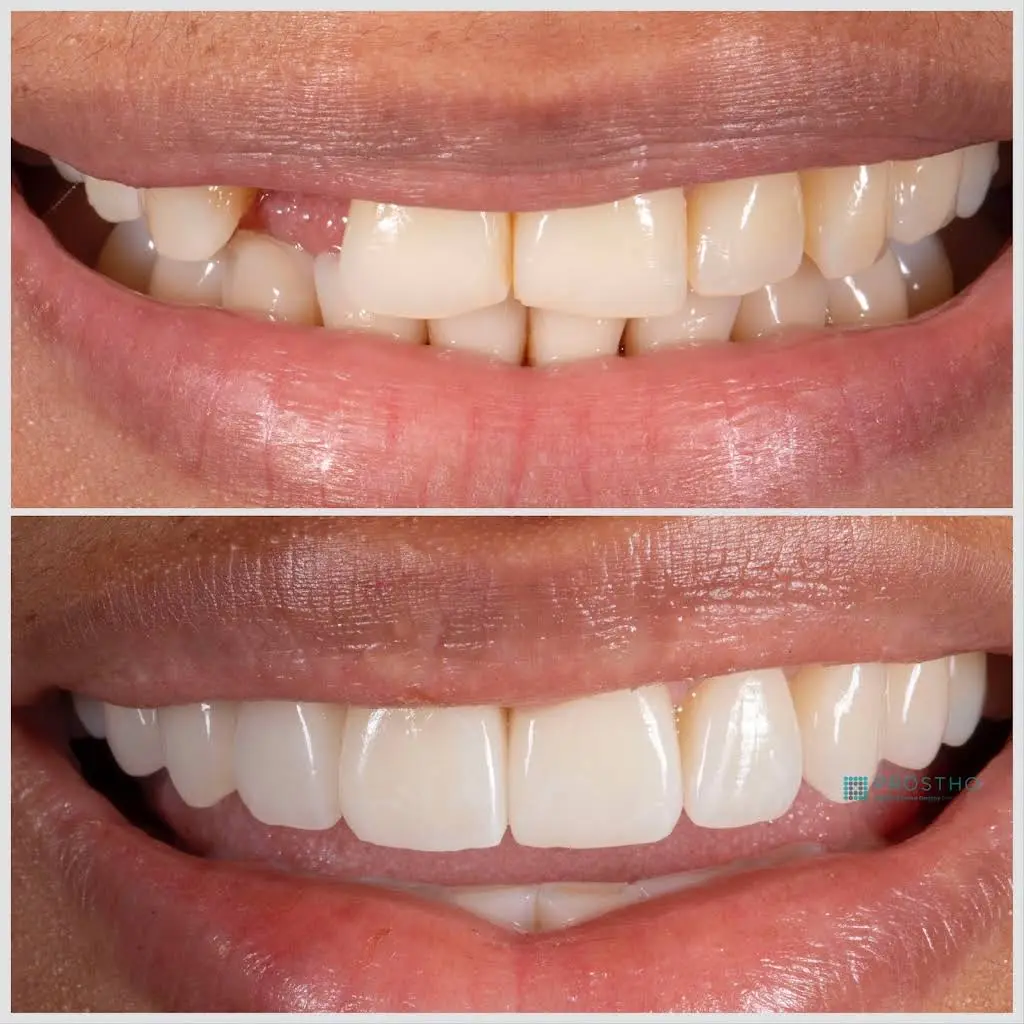 Prostho Endo Dental Specialists Aesthetic & Implant Dentistry at Vienna